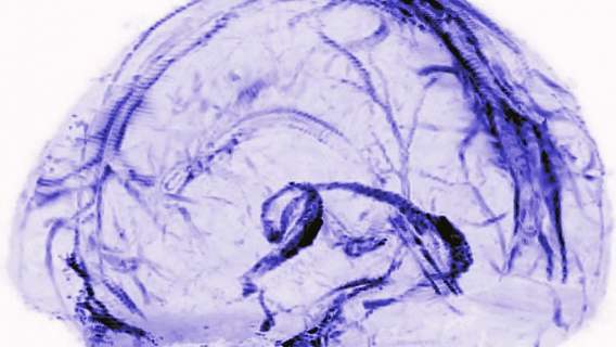 Koronawirus może postarzyć mózg o 10 lat? Przyglądamy się nowemu badaniu